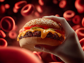 Chemical fingerprints reveal fast food consumption