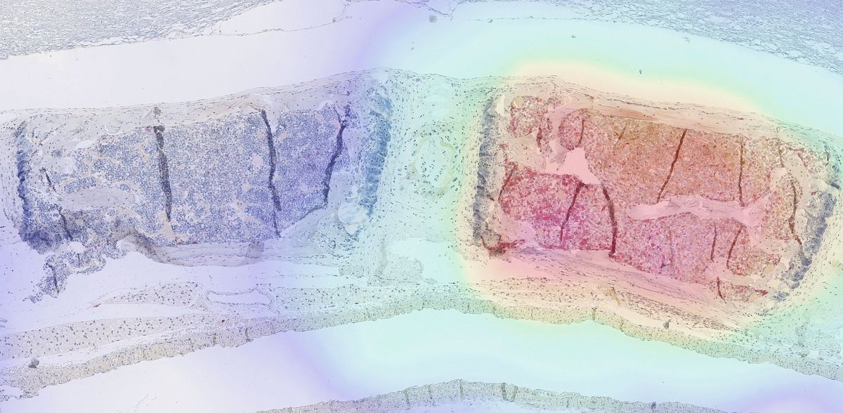 Tracking immune cells inside the body