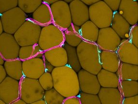 How excessive fat tissue affects our blood vessels