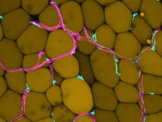 How excessive fat tissue affects our blood vessels
