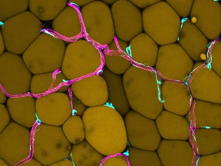 How excessive fat tissue affects our blood vessels