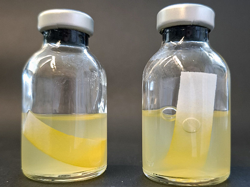 Pigments that can do more - New discovery sheds light on the bacterial use of biomass with potential for biofuels and new antibiotics