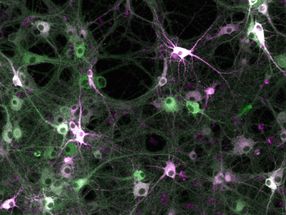 Investigating kinase activity in living cells: Scientists build molecular recording tool
