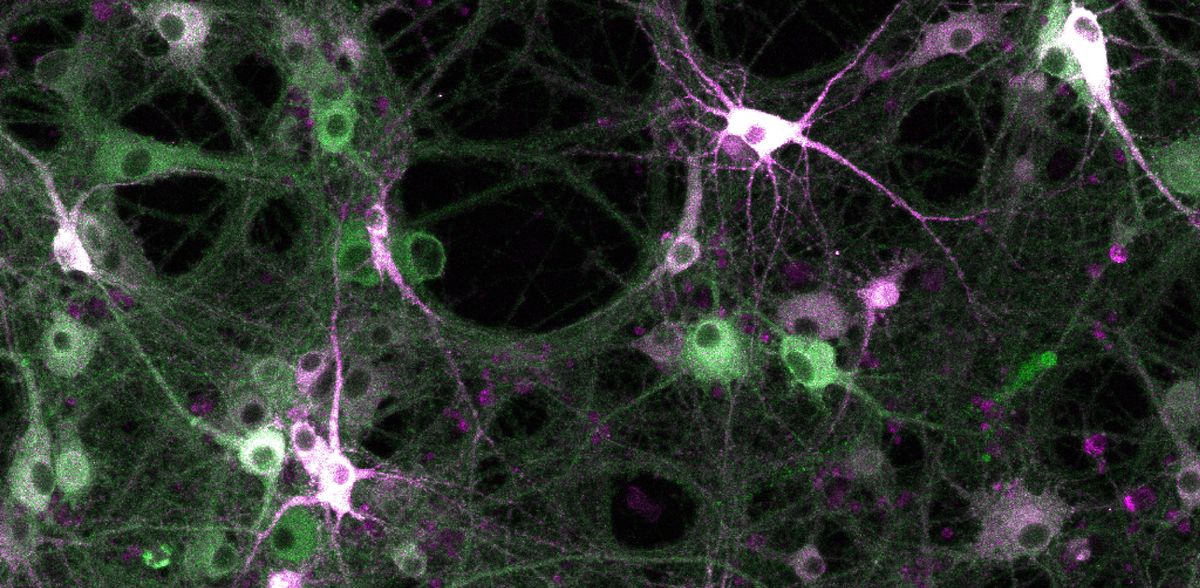 Investigating kinase activity in living cells: Scientists build molecular recording tool