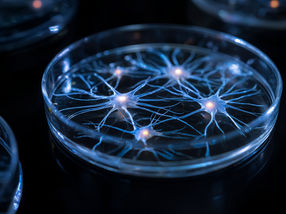 Over 400 different types of nerve cell have been grown – far more than ever before