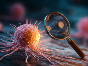 An advanced imaging technique detects cancer with unprecedented precision