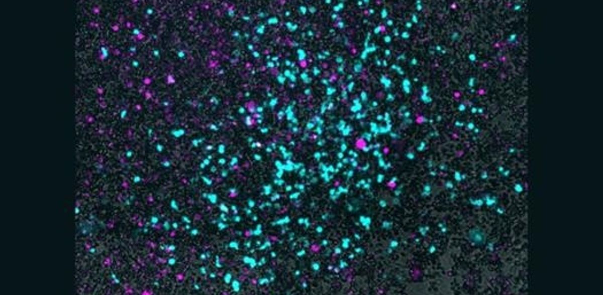 Using bacteria to sneak viruses into tumors
