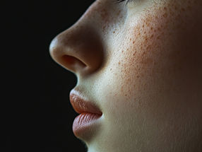Insights into olfactory disorders in Alzheimer's disease