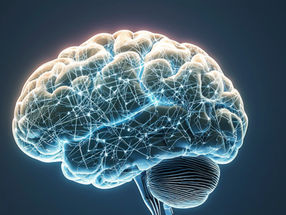 This protein slows the aging brain and we know how to counter it