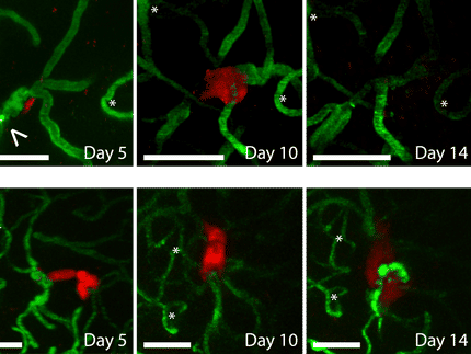 Anticoagulants reduce the number of brain metastases in mice